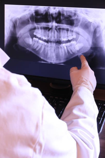 Best Emergency Gum Treatment in St Peter, MN