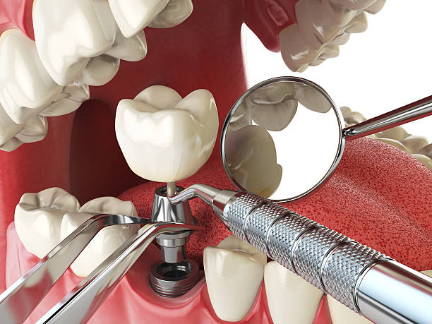 Best Same-Day Emergency Dental Services in St Peter, MN
