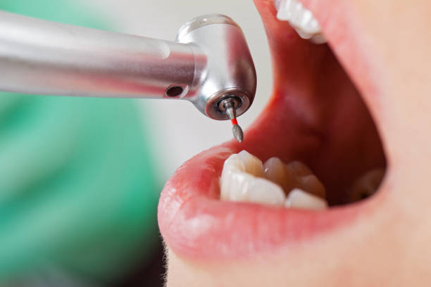Best Weekend Emergency Dentist in St Peter, MN